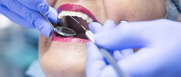 Best Emergency Treatment for Dental Infections or Abscesses in New Kingman Butler, AZ